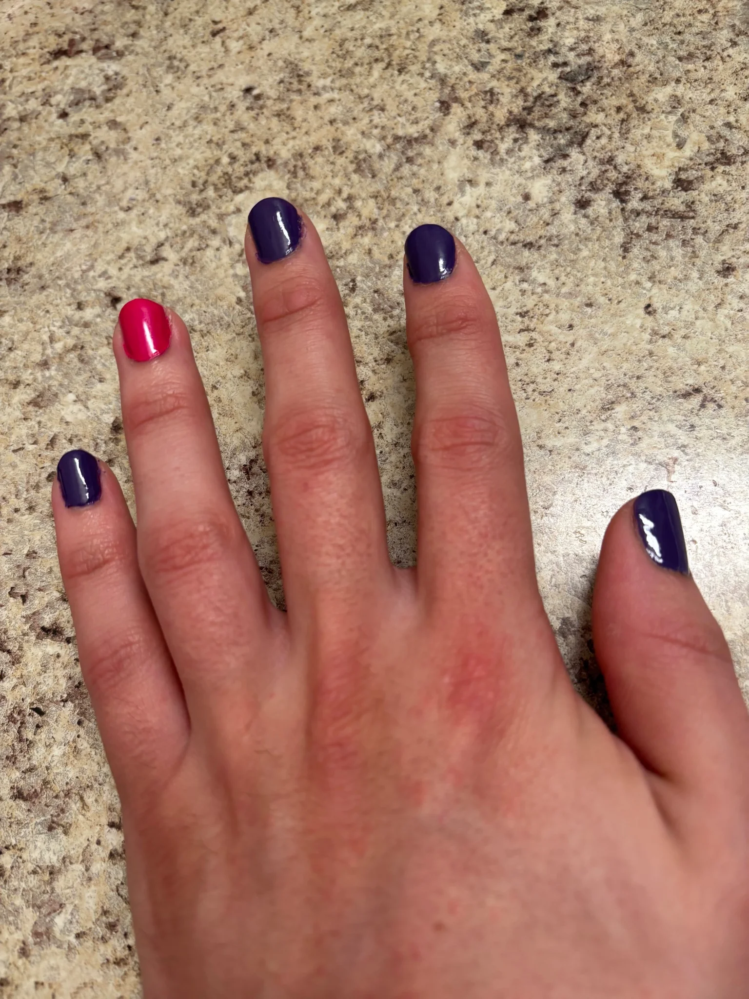 tidy's left hand rests upon this faux granite countertop, notably their nails are dark purple, except the ring finger, which is quite bright pink