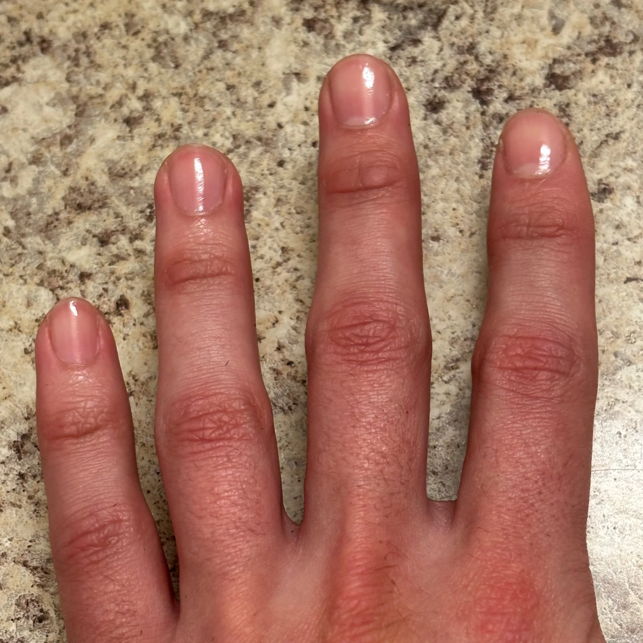 tidy's pinkie through index fingers resting on the faux granite of a bathroom counter 