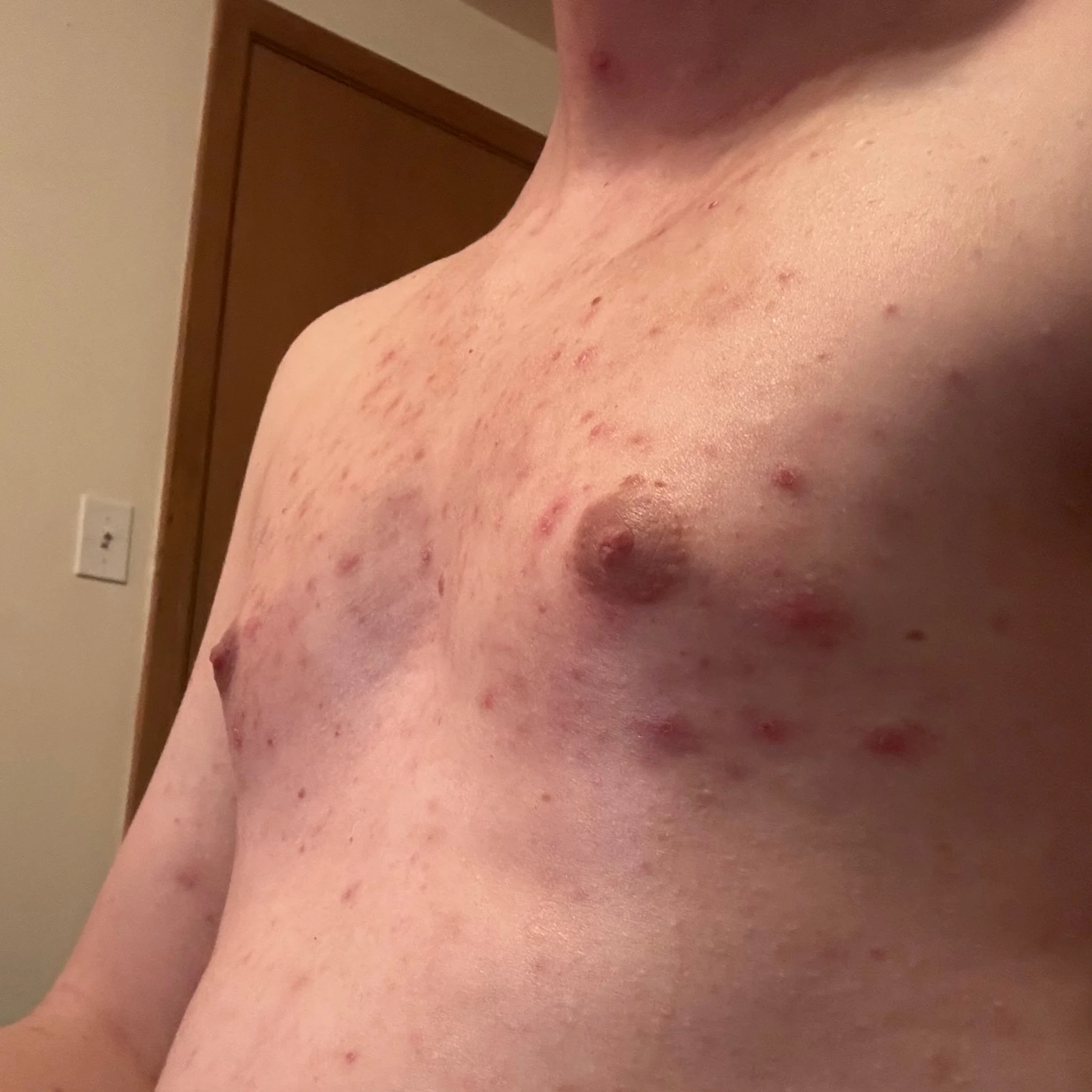 my tiny, highly complexioned boobs, barely looking like anything more than pecs
my door and light switch can be seen in the background